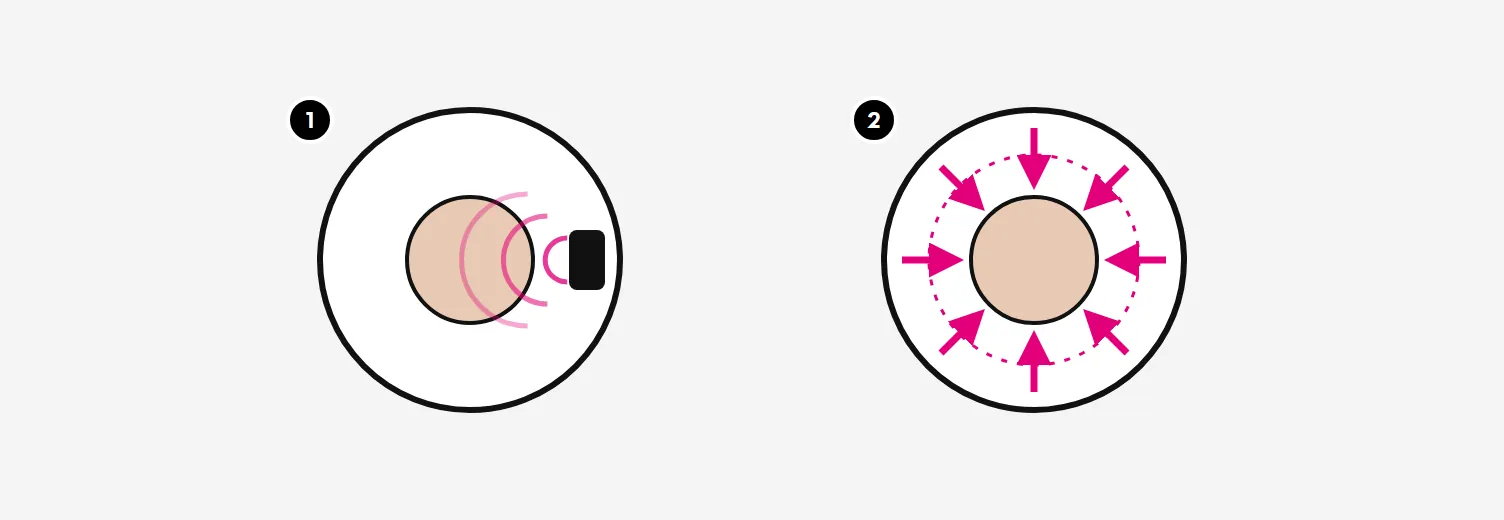 Illustration: ordinary vibration from one point compared with SenSonic sound waves from every side